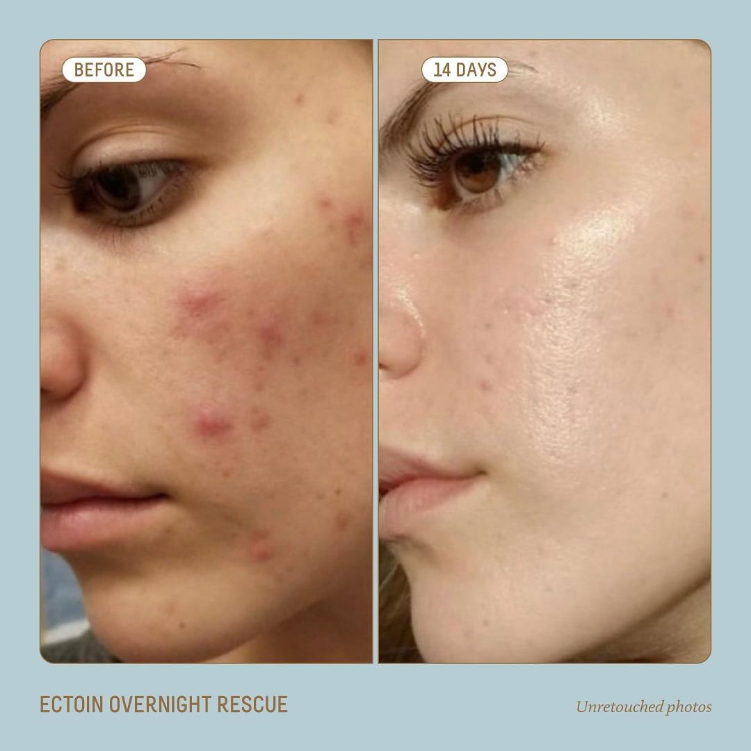 The Ordinary 'Buffet' + Copper Peptides 1% | Anti-Aging Power Serum